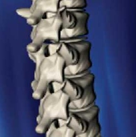 spine.jpg